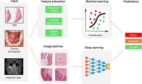 Mouth cancer, also known as oral cancer, is where a tumour develops in a part of the mouth. Artificial Intelligence Based Methods In Head And Neck Cancer Diagnosis An Overview British Journal Of Cancer