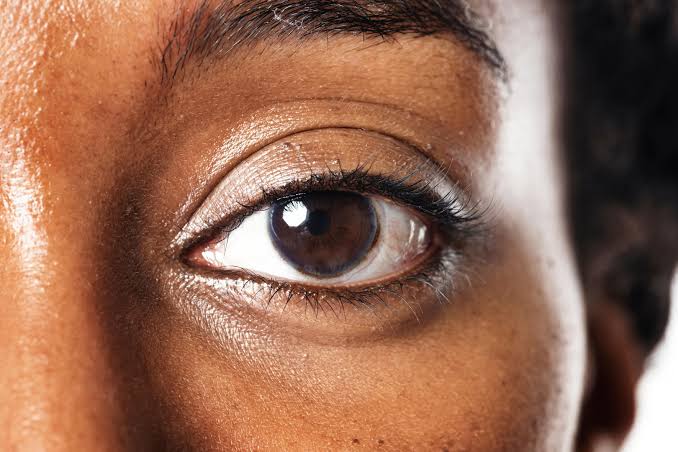 What causes dry eye syndrome, and how do you cure it? | Daily Nation