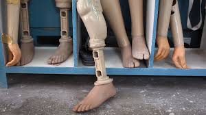 I have to admit, though, that it doesn't look as. The Geniuses Who Invented Prosthetic Limbs Bbc Future
