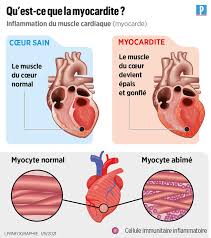 Un liquide lubrifiant se trouve entre les deux membranes. Vaccination Pfizer Ou Moderna Faut Il S Inquieter Des Cas De Myocardite Et De Pericardite Le Parisien