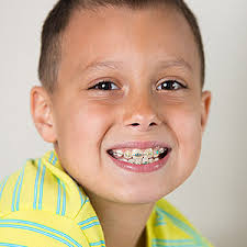 To help lessen her anxiety, girardi, then 45 years old, made a deal: Braces Take Advantage Of Teeth S Natural Ability To Move Daniel P Jones Dds Inc