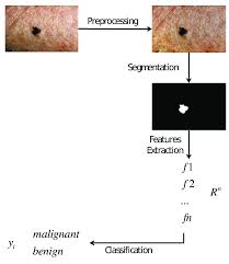 However, with this new research, scientists are claiming to solve the early detection issue of skin cancer with the help of artificial intelligence. The Basic Work Flow Of Automatic Skin Cancer Detection Download Scientific Diagram