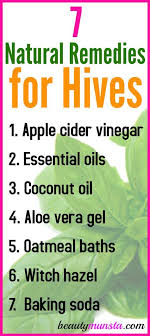 7 Natural Remedies For Hives Beautymunsta Free Natural Beauty Hacks And More Natural Remedies For Hives Hives Remedies Natural Healing Remedies