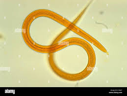 Image result for Strongyloides