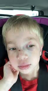 Mary's accident and road to recovery