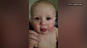 Kentucky parents share experience with Kawasaki Disease