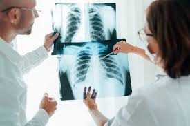 Při zvažování diagnosy plicní embolie posuzujeme vedle klinických projevů přítomnost rizikových faktorů, laboratorní testy, ekg a rtg hrudníku. Zradny Covid Lekari Nachazeji Zmeny Na Plicich I U Lidi Kteri Se Citi Dobre Seznam Zpravy