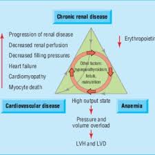Chronic kidney disease (ckd) is a type of kidney disease in which there is gradual loss of kidney function over a period of months to years. Pdf Chronic Renal Disease