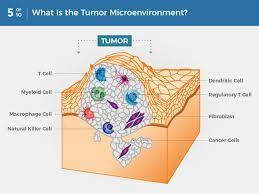 Radiation can be used to destroy a tumor or to relieve pain. What Is Cancer National Cancer Institute