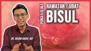Jika anda pernah punya bisul, pasti anda tahu bahwa bekasnya yang besar itu tidak enak dipandang. Bisul Ubat Dan Rawatan Yang Berkesan Punca Penyebab Bisul Di Punggung Ketiak Dan Kemaluan Youtube