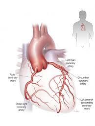 The right coronary artery and left coronary artery. Coronary Artery Disease And Coronary Bypass Surgery