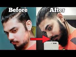 How To Grow A Beard Faster Naturally At Home Fill Patchy Beard Asad Ansari Youtube Grow Beard Patchy Beard Beard