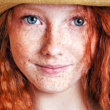 Die Genetik der Rothaarigen