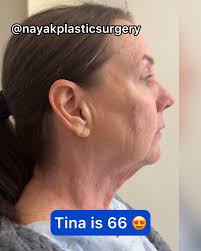 Nayak Plastic Surgery added a new...