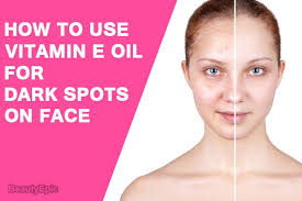 How To Use Vitamin E Oil For Dark Spots On Face Facial Skin Care Spots On Face Natural Skin Care Remedies