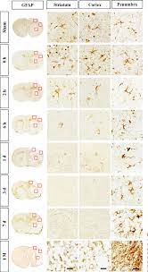 From viral sequence to protein function. Proteine Atlas Rat A Human Liver Cell Atlas Revealing Cell Type Heterogeneity And Adult Liver Progenitors By Single Cell Rna Sequencing Biorxiv From Viral Sequence To Protein Function Gadget Info