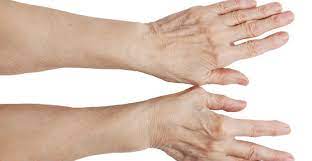 We did not find results for: Causes Of Bulging Hand Veins Treatment Veins On Hands Removal Miami