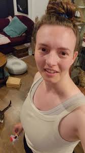 Sweet Moment with Ginger the Disabled Cat in Wheelchair