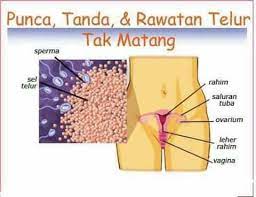 Setiap perempuan sebaiknya mengenali tanda ovulasi gagal berikut ini. Keluarga Bahagia By Ehps K Hamil Kalau Telur Ovum Tak Matang Ini Kes Serius Telur Yang Matang Berukuran Diantara 12mm 25mm Jika Kurang Dari Saiz Berkenaan Kebarangkalian Untuk Disenyawakan Tak Akan Berlaku