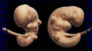 6 Schwangerschafts Woche Ssw 5 Babywelten Ch