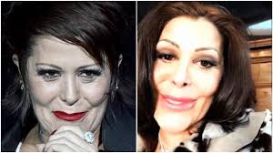 Frida ofreció una entrevista para el programa. Alejandra Guzman Y Sus Cirugias Esteticas Fotos Un1on Yucatan