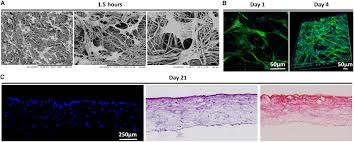 A influencer quer alguém que faça tudo por um preço só e não estaria encontrando. Frontiers A Developmental Engineering Based Approach To Bone Repair Endochondral Priming Enhances Vascularization And New Bone Formation In A Critical Size Defect Bioengineering And Biotechnology
