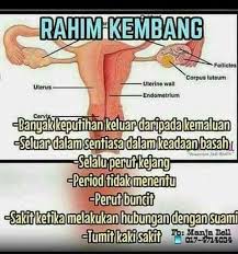 Masalah perut buncit ini dikarenakan perut adalah salah satu komponen tubuh yang mempunyai. Rahim Kembang Punca Perut Buncit Sal Kaa