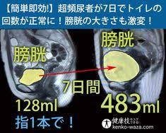 指1本で即効 超頻尿者が7日で1日のトイレの回数が23回から8回に 膀胱の大きさも激変 膀胱 ヘルスフィットネス 健康になる