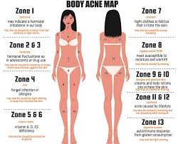 6 Ways To Alkalize Your Body Daily Body Acne Map Acne Mapping Chest Acne