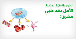 فلا فرق في الدين الإسلامي بين زراعة الخلايا الجذعية وبين زراعة سائر خلايا الإنسان الأخرى، كما أنه لا فرق بين زراعة الخلايا وبين وعليه فلا حرج في نقل الخلايا الجذعية من إنسان وزراعتها لإنسان آخر، بشرط أن يأذن الحي في نقلها منه، وأن لا يكون عليه في ذلك ضرر، أو يأذن. Ø¹Ù„Ø§Ø¬ Ø¨Ø§Ù„Ø®Ù„Ø§ÙŠØ§ Ø§Ù„Ø¬Ø°Ø¹ÙŠØ© Ø§Ù„Ø£Ù…Ù„ Ø¨ØºØ¯ Ø·Ø¨ÙŠ Ù…Ø´Ø±Ù‚ ÙˆÙŠØ¨ Ø·Ø¨