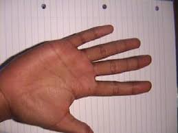 I'll leave their meaning up to you! About Hands Unusual Hands Palmistry Information