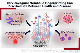 A persistent feeling of nausea or indigestion can be a sign of cancer, and that includes cervical cancer, says shirazian. Novel Study Discovers Metabolic Fingerprint To Help Treat Diagnosis And Prevent Cervical Cancer