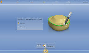 Cerec Software 4 6