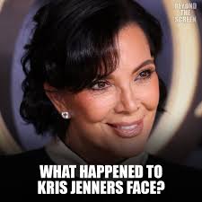 What happened to Kris Jenners face? #krisjenner #plasticsurgery  #celebritynews