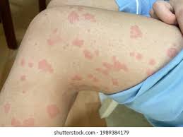 Image result for Wheal