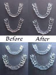 We did not find results for: How To Clean Invisalign Retainers At Home Arxiusarquitectura