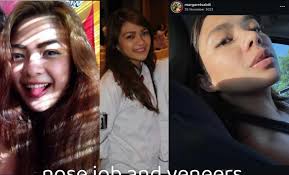 Since we're talking about former Mayor of Lipa City (in office 2010-2019)  and former Chairperson of the Presidential Commission for the Urban Poor  (in office 2024-2025), Maynard Sabili let me introduce the