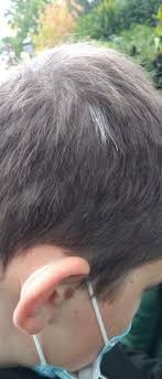 Premature white hair can affect young people as well, starting with teenagers at the age of 15, 16, 20, 25 to even 30 years. My Littlebrother Has A Few White Hair Strand And He S Only 13 Mildlyinteresting