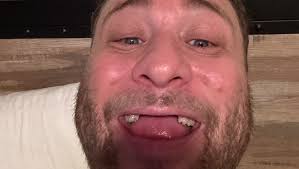 Fundraiser by Dusty Moore : Donate to Help Dusty Regain the Ability to Eat  and Speak