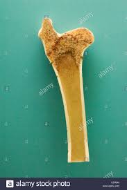 Bone cross section illustrations & vectors. Bone Cross Section Stockfotos Und Bilder Kaufen Alamy