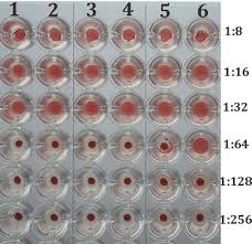 Image result for Embelia ruminata