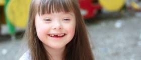 Interesting facts about Fragile X syndrome