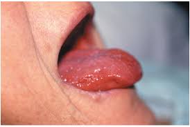 Image result for Isoglossa namuliensis