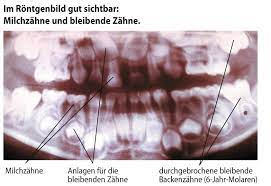 Zu meiner zeit war das ja immer so wenn man zur schule ging mit 7 jahen aber die kindliche entwicklung hat sich ja geändert? Zahnaerzte Hh Milchzahne