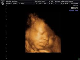 Pregnancy Journey + Meet Lucy!