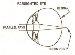 Improve Your Eyesight Naturally With Eye Exercises Mother Earth News