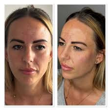 Elite Beauty & Aesthetics Manchester