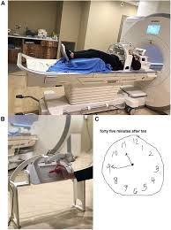 All clock numbers must be present with no additional numbers. Frontiers The Neural Correlates Of The Clock Drawing Test In Healthy Aging Human Neuroscience