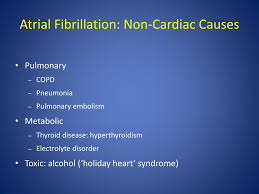 Ppt Arrhythmia 341 Powerpoint Presentation Free Download Id 2352358