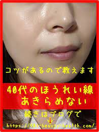 ほうれい線 消す方法はあるの ほうれい線 美容 化粧品